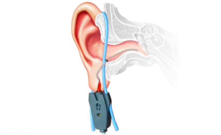 SONDA MICROFÓNICA